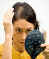 hair_loss__balding__hair_shedding__alopecia_by_husnainshahseo-d8ahnwx.jpg