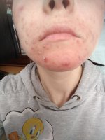 IMG_20180323_104032.jpg